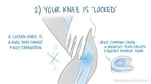 Moving into a new place, losing your keys, enhancing your security or just wanting to feel safer are very good reasons for replacing the locks in your home. Is My Knee Injury Serious 5 Signs To Look For