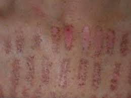 Because depilatory creams burn the hair, they can. Pin On Best Of Beauty Treatments