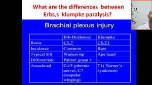 Maybe you would like to learn more about one of these? What Are The Differences Between Erbs Palsy And Klumpke Paralysis Horner Syndrome Palmer Grasp Ape Youtube