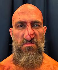 Tommaso Ciampa shows the aftermath of his tag team match against MCMG at  the Royal Rumble
