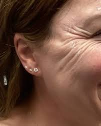 Kelley Powers, MPA PA-C (@derm_powers) • Instagram photos and videos