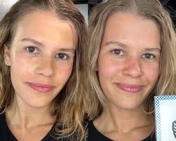 10 Best Drugstore Vitamin C Serums, Tested and Reviewed