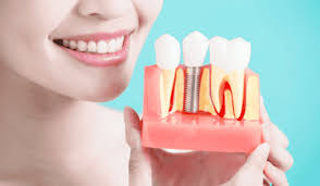 VCAD Dental Laboratory