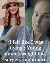 A young mum says weight loss surgery left her dependent