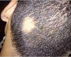 Can Lavender Essential Oil Trigger Hair Growth Quora