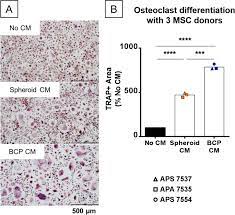 We did not find results for: Apoptotic Mesenchymal Stromal Cells Support Osteoclastogenesis While Inhibiting Multinucleated Giant Cells Formation In Vitro Scientific Reports