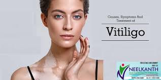 Hair & Skin Hospital in Mandi Archives