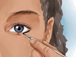 Mar 21, 2019 · take a clean washcloth and soak it with warm water. How To Get Rid Of A Stye 11 Steps With Pictures Wikihow