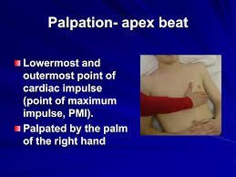 Image result for Point of Maximum Impulse