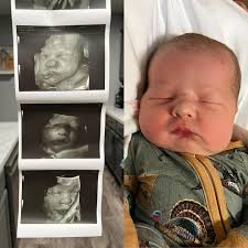 This sweet boy was ALL cheeks in his 3D/4D sonogram! 🤗 He was born a  little less than 6 weeks after his imaging, and he looks JUST LIKE his  ultrasound 😍✨ Thank