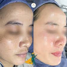 Thẩm Mỹ Uyên Lee Đà-Nẵng