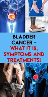 Pin On Prevent Cancer