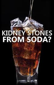 Dr Oz How To Prevent Kidney Stones Does Soda Cause Kidney Stones Kidney Stones What Causes Kidney Stones Kidney