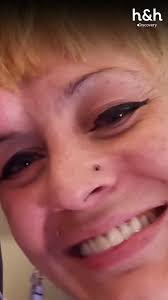 Tras un cuarto de siglo con un bulto poco común en su cara, esta mujer  busca la intervención de una experta para recuperar su autoestima y  seguridad. ¿Lo logrará? 👩‍⚕️⚠️😯 ...