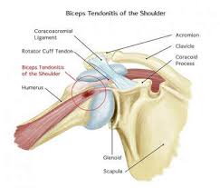 Located superior to the shoulder joint, the deltoid muscle works with the supraspinatus to abduct the arm at the shoulder. Shoulder Pain Rancho Cucamonga Ca Rancho Cucamonga Chiropractor For Shoulder Pain Chiropractor Rancho Cucamonga Rancho Cucamonga Sports Chiropractor Rancho Cucamonga Personal Injury Chiropractor Rancho Cucamonga Auto