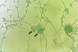 In its ecological niche, the fungus has learned how to adapt and proliferate in hostile environments. Aspergillus Fumigatus Microscopic Characteristics A Single Series Of Download Scientific Diagram