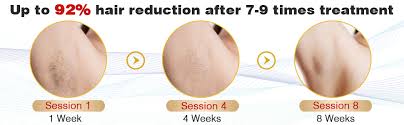 This prices are not comparable to what the market charges for similar procedures. Amazon Com Laser Hair Removal Permanent Imene Painless Ipl Hair Removal Ideal For Women Men Bikini Legs Arms Armpits Hair Remover Uses Most Effective Ipl Technology Intense Pulsed Light Yellow