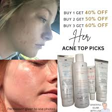 What are safe ways to target fine lines and wrinkles?