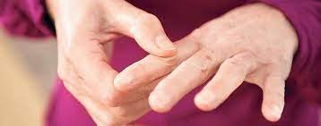 Fingerarthrose Oder Rheuma Was Einen Finger Krumm Macht Wissen Tagesspiegel