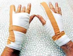 Zwei Hände Brechen Von Knochen In Bandagen Eingewickelt Lizenzfreie Fotos,  Bilder Und Stock Fotografie. Image 18159969.