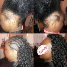 Crochets Are Great For Alopecia As The Net Let S Your Scalp Breathe With No Stress To The Re Braids For Thin Hair Braids With Alopecia Hairstyles For Alopecia