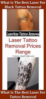 Pin On Tattoo Removal