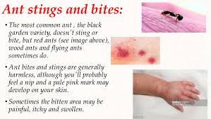 Ant species that do not swarm do not have winged members, and they increase their populations through budding. Surgery Insects Bites