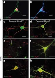 We did not find results for: Astrocytes Expressing Als Linked Mutated Sod1 Release Factors Selectively Toxic To Motor Neurons Nature Neuroscience