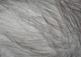 It can also appear on their lips. Black Dots On Scalp That Scratch Off Spots On Scalp Causes Symptoms Treatments And Remedies
