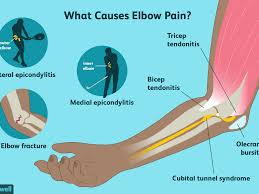It causes pain in the backside of the elbow and forearm, along the thumb side when the arm is . Elbow Pain Causes Treatment And When To See A Doctor