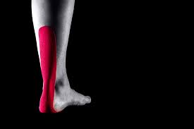 Image result for Taping for Soleus and Achilles