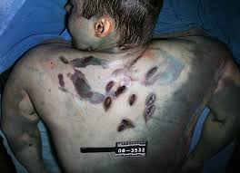 Download and use 6,000+ crime scene stock photos for free. Graphic Autopsy Photos Travis Alexander Ferisgraphics