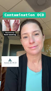 Understanding Contamination OCD and Effective ERP Treatment