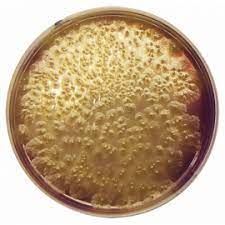 We did not find results for: Clostridium Perfringens Agar Base M Cp Formato 500 G