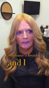 Brenda's Hair Transformation Journey with SkalpD Hair Solution