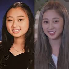 Did Ning Ning from Aespa undergo plastic surgery?