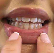 Pin By Iyesha On Moi Tooth Gem Teeth Jewelry Smiley Piercing