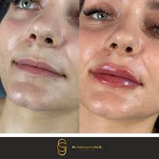 Dr. Santiago Gallo R