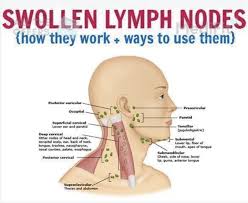 Posterior cervical lymph nodes pain. Yedao Naturtherapy Lymphatic Drainage Ginger Oil Hot
