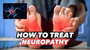 Image result for Peripheral Neuropathy