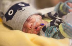 Timelapse video of premature baby Walker Pruett born weighing 1lb