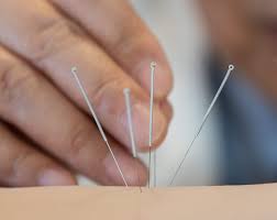 Some plans may have visit limits, dollar limits or referral requirements. Appointments Weidong Lu