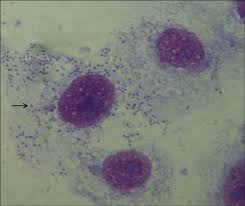 Image result for Rickettsiae