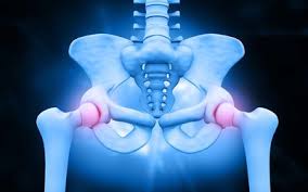 Groin pain in women can be mild or severe. Female Groin Pain Causes And Treatments