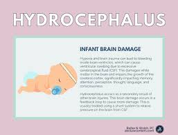 Image result for Hydrocephalus