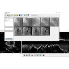 Check spelling or type a new query. Dicom Viewer Rubo Medical Imaging