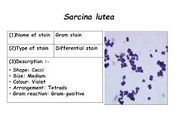 All microscopy images were captured using the richter optica u2 biological microscope and a microscope camera with software. Ppt Principle Of Staining Technique Powerpoint Presentation Free Download Id 2127901