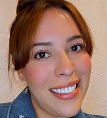 Teacher Travels to Beverly Hills for Eye Freckle Removal