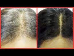 Turn Gray Hair Black In 30 Minutes Natural Fast Acting Homemade Hair Dye Khichi Beauty Youtube Homemade Hair Dye Dyed Hair Black And Grey Hair