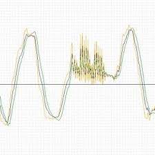 Kalman Filter Vs Complementary Filter Kalman Filter Filters Accelerometers